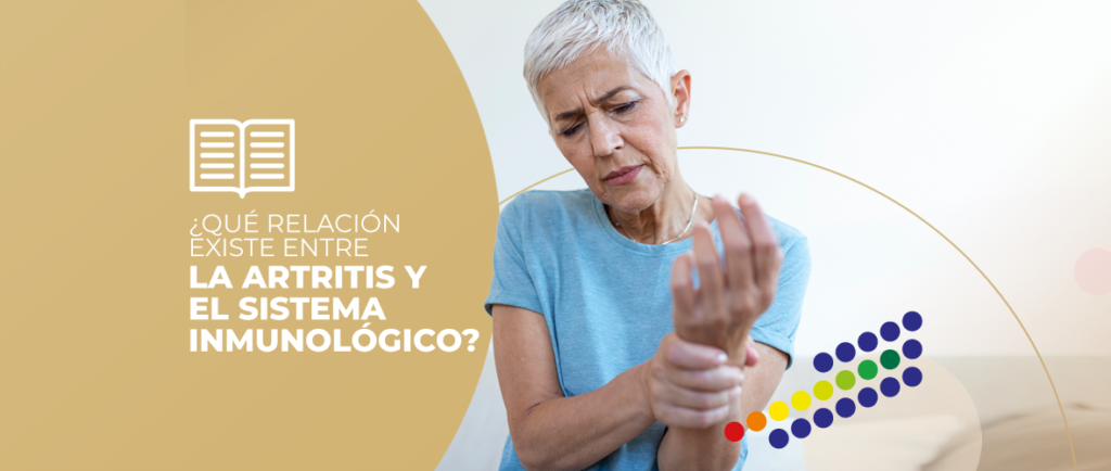 Ilustración de articulación afectada por artritis y células inmunológicas