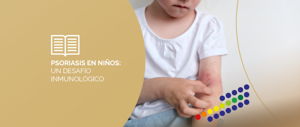 Niño con lesiones de psoriasis
